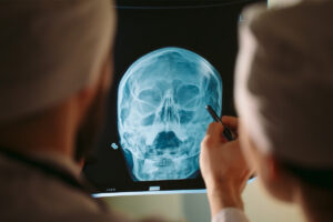 Traumatic Brain Injury, tbi, brain injury lawyers tulsa, personal injury attorneys OK