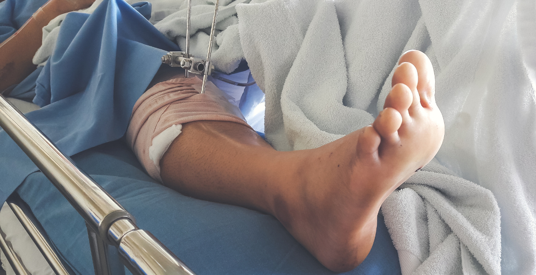 Common Injuries in Parking Lot Slip and Fall